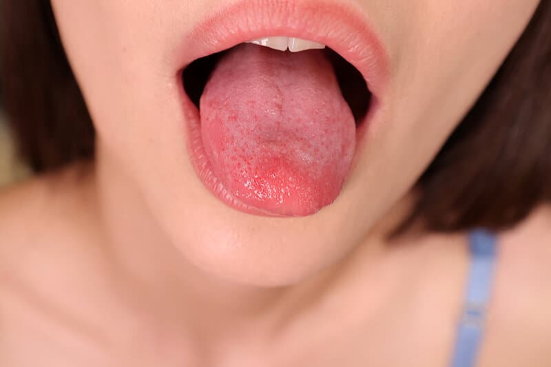 FMDL-003 [VR] 亲吻疯狂的荡妇，每天[舔]不同男人的嘴東條なつ