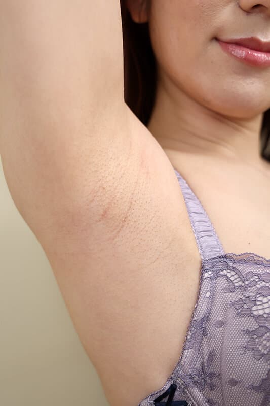 VRKM-1531     【VR】卑猥な腋に発情してしまった件 美女の腋と乳が一番チ〇ポに効く説ノーカット458分BEST